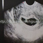 51岁大龄女性能通过三代试管借精生子吗