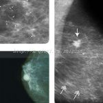 娄底第三代试管男孩多还是女孩多?三代试管包生男孩价格2023 娄底第三代试管男孩多还是女孩多?三代试管包生男孩价格2023
